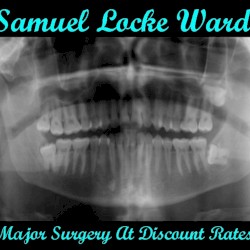 Major Surgery at Discount Rates