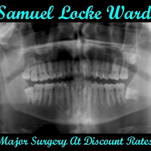Major Surgery at Discount Rates