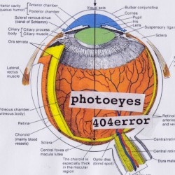 Photoeyes