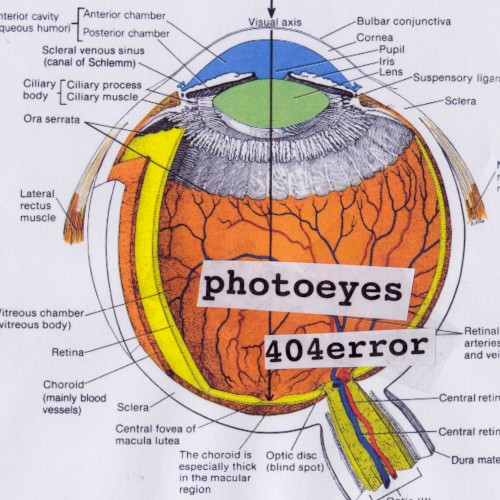 Photoeyes