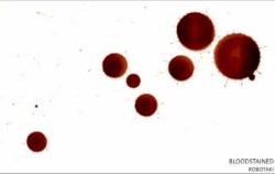 Bloodstained