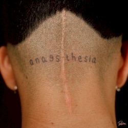 Anaesthesia