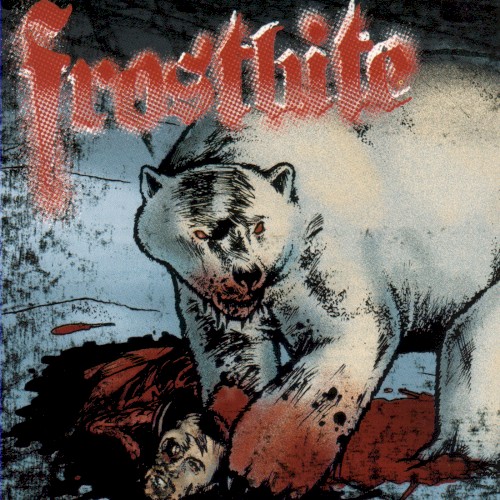 Frostbite