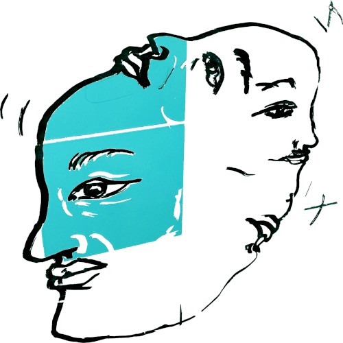 Supratemporal Dissociations