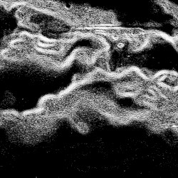 SYNESOMNIAC