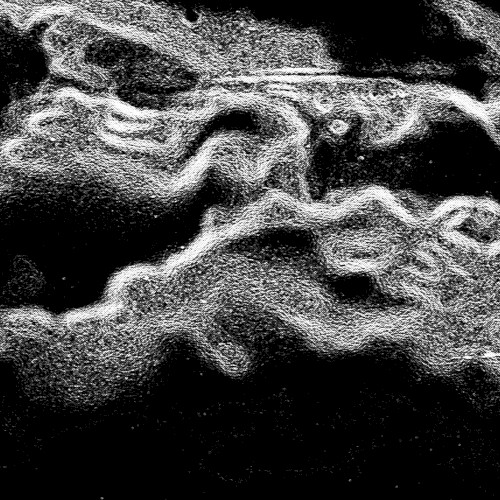 SYNESOMNIAC