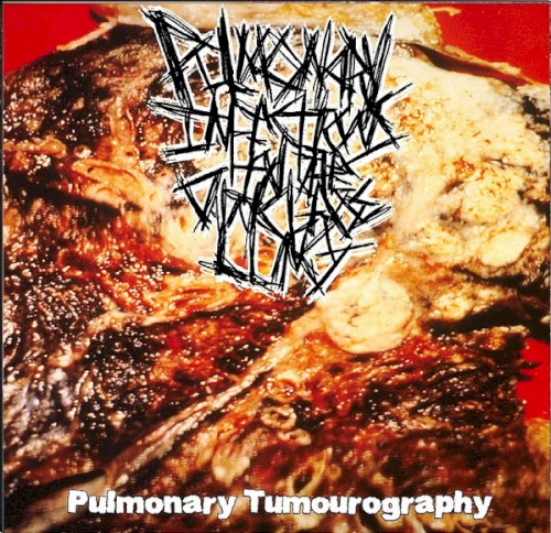 Pulmonary Tumourography