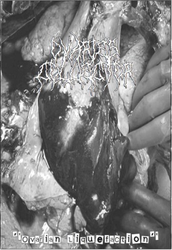 Ovarian Liquefaction